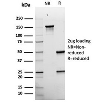 Recombinant PMEL17 Antibody / Melanoma gp100