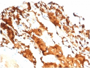 Recombinant Surfactant protein D Antibody / SFTPD