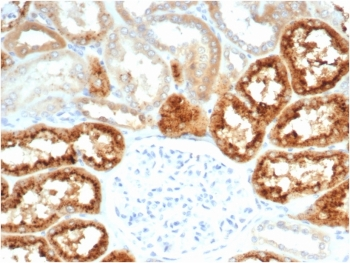 Recombinant Retinol Binding Protein 4 Antibody / RBP4