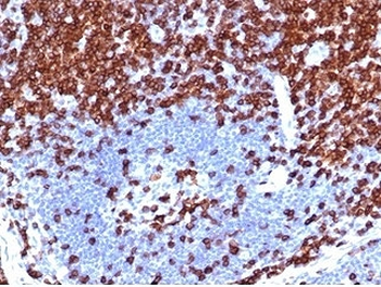 Recombinant CD5 Antibody