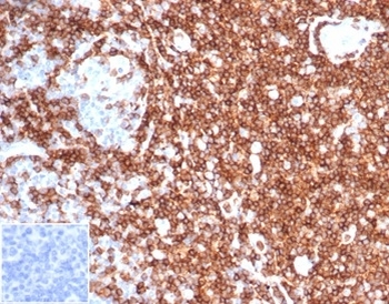 SPN Antibody / CD43