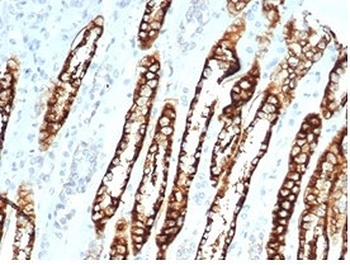 Recombinant CDH16 Antibody / Cadherin 16