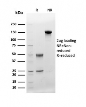 CD48 Antibody (Pan Leukocyte Marker)