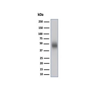 CD48 Antibody (Pan Leukocyte Marker)