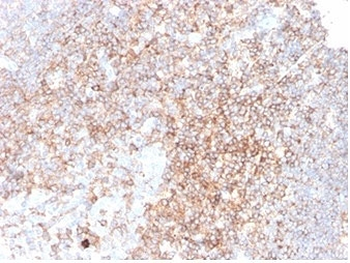 CD48 Antibody (Pan Leukocyte Marker)