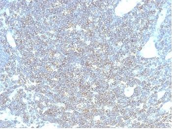 CD48 Antibody (Pan Leukocyte Marker)