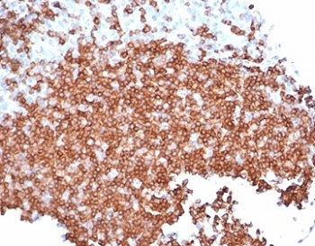 Recombinant CD22 Antibody