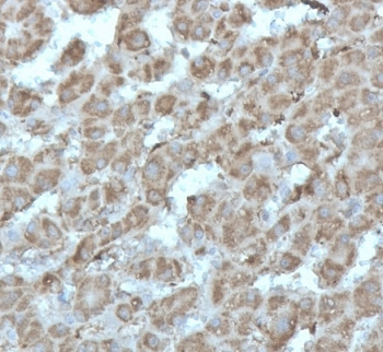 Recombinant DNA topoisomerase I Antibody / TOP1MT