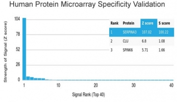 AACT Antibody / Alpha-1-Antichymotrypsin / SERPINA3
