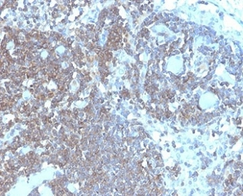 CD48 Antibody (Pan Leukocyte Marker)