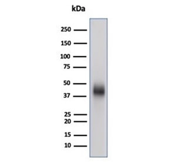 CD48 Antibody (Pan Leukocyte Marker)