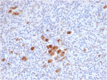 Recombinant CD30 Antibody