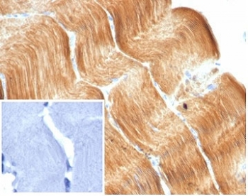 Recombinant Alpha Actinin 2 Antibody / ACTN2 / Sarcomeric Alpha Actinin