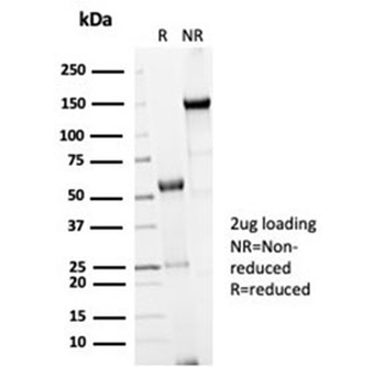 Recombinant Cdc20 Antibody