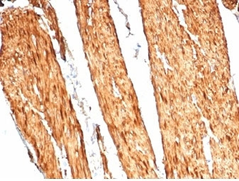 Recombinant CAD Antibody / CALD1 / Caldesmon