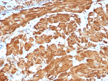 Recombinant Actin Antibody / ACTA2 / Smooth Muscle