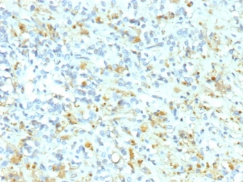 Recombinant Anaplastic Lymphoma Kinase Antibody / ALK