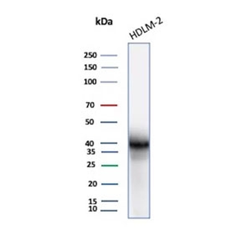 Recombinant PD-L1 Antibody / B7-H1 / CD274