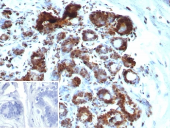 Recombinant BRCA1-Associated Protein 1 Antibody / BAP1