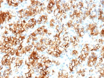 Recombinant Carbonic Anhydrase 9 Antibody / CA9