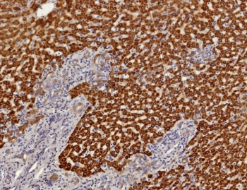 ARK1C1 Antibody / Aldo-keto Reductase Family 1 Member C1