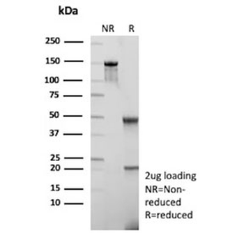 ARK1C1 Antibody / Aldo-keto Reductase Family 1 Member C1