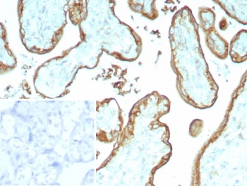 CD147 / Emmprin / Basigin Antibody