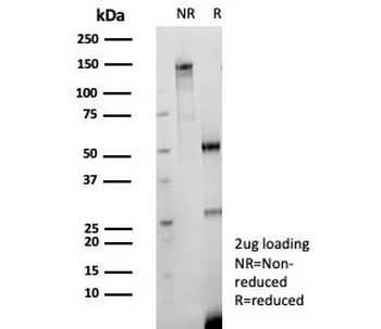 CD147 / Emmprin / Basigin Antibody
