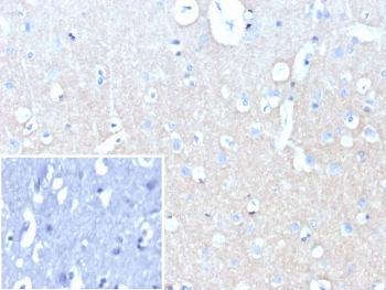 Recombinant NCAM-L1 Antibody / CD171 / L1CAM