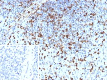 S100A4 Antibody / FSP1