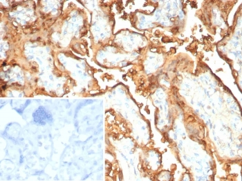 Recombinant S100P Antibody / MIG9