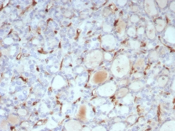 Recombinant TSH Receptor Antibody / B-Chain