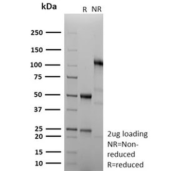 Cyclin B1 Antibody / CCNB1