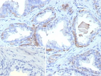 Recombinant KRT13 Antibody / Cytokeratin 13