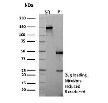 E-Cadherin Antibody / CDH1
