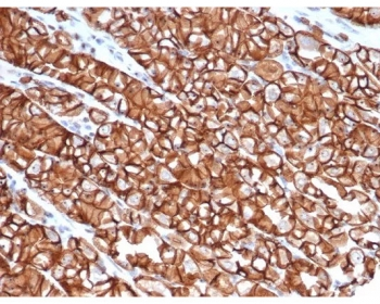 E-Cadherin Antibody / CDH1