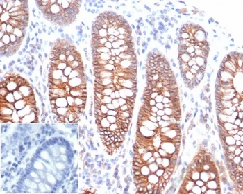 E-Cadherin Antibody / CDH1