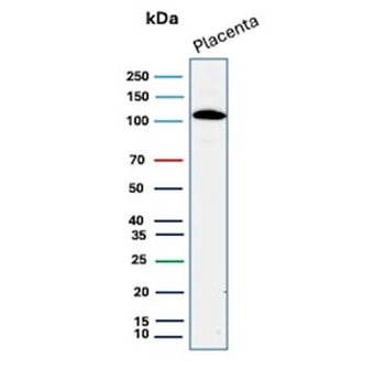 E-Cadherin Antibody / CDH1