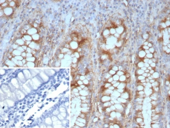 E-Cadherin Antibody / CDH1