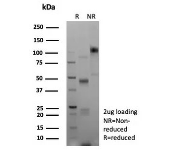 E-Cadherin Antibody / CDH1