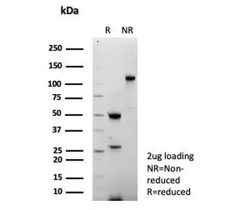 Thymidylate Synthase Antibody