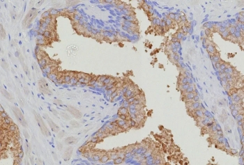 Thymidylate Synthase Antibody