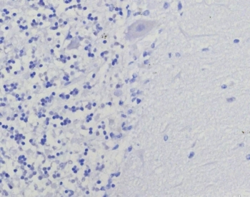 Thymidylate Synthase Antibody