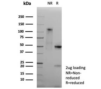 Pan-HLA Antibody MHC II (DP/DQ/DR)