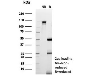 CD3 delta Antibody / CD3D