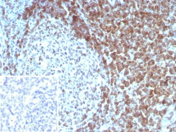 CD3 delta Antibody / CD3D