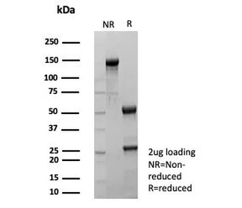 Estrogen Inducible Protein pS2 / TFF1 Antibody
