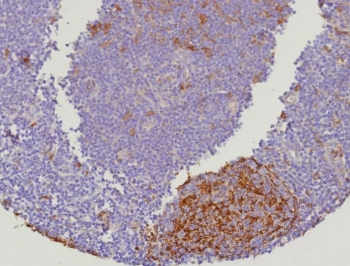 Recombinant Cystatin A Antibody / CSTA