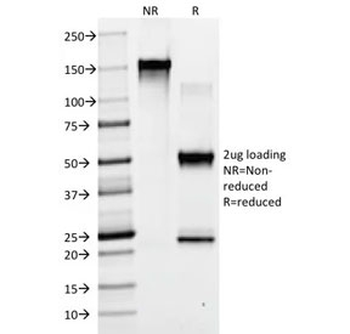 Mouse IgG1 Antibody / Isotype Control for Mouse
