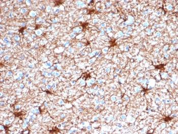 Glial Fibrillary Acidic Protein Antibody / GFAP